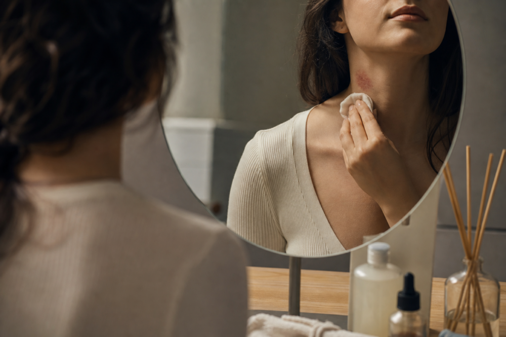 A Short Action Plan If Hickeys Make You Uncomfortable